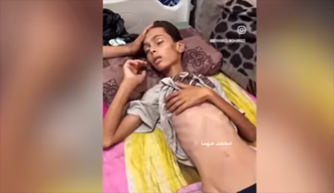 Kelaparan parah landa Gaza/Foto: tangkap layar YouTube Al Jazeera English